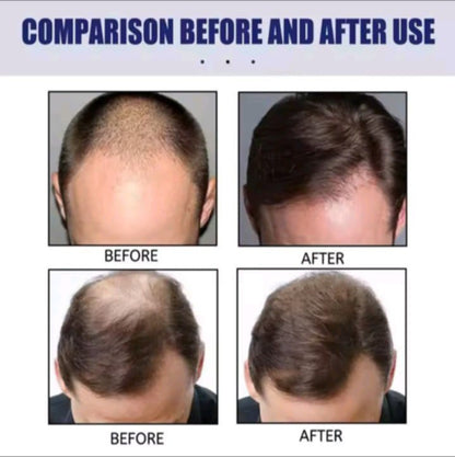 Hair Building Fibers - Instant Hair Loss Solution ⭐⭐⭐⭐⭐ (4.5/5) Ratings
