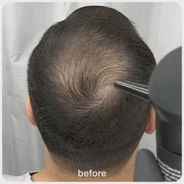 Hair Building Fibers - Instant Hair Loss Solution ⭐⭐⭐⭐⭐ (4.5/5) Ratings